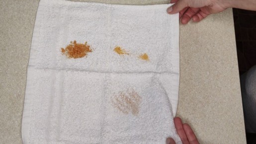 Как вернуть кухонным полотенцам свежесть и чистоту